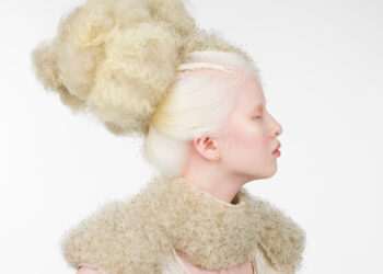 ‘Being different is good’: the teen model making fashion more inclusive