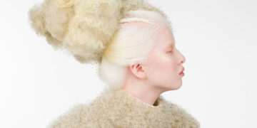 ‘Being different is good’: the teen model making fashion more inclusive