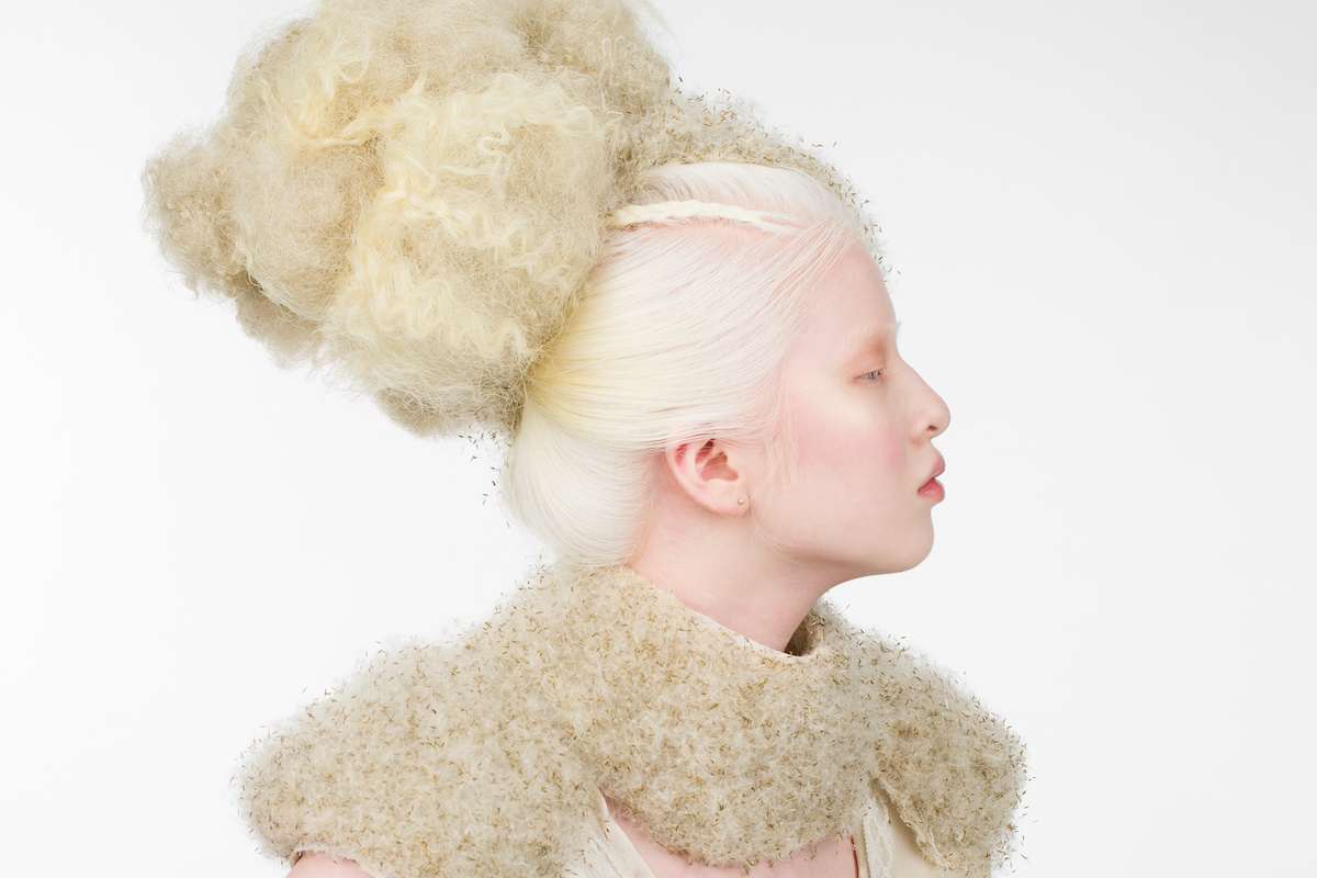 ‘Being different is good’: the teen model making fashion more inclusive