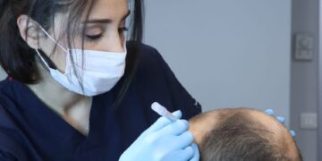 Istanbul, a city that hosts many patients from Europe, Asia, and Africa who has the intention of getting hair transplantation, knows no rivals in this regard. The hair transplant operation has become the number one in Istanbul health tourism in terms of affordable prices, operation volume, and experience. Pure Line Clinic Operations Manager Selim Peltekci says, “The prices are low compared to the average number in the world. Besides, hair transplantation is performed by experts who exceed world standards in the field, and patients are thoroughly informed about the operations. These are the reasons why people prefer us.” Hair transplantation is one of the most popular aesthetic interventions in recent years. In the field of hair transplants, which have been performed in Turkey for more than a decade now, significant progress has been made in recent years. For instance, while Arabs were already interested in getting hair transplant treatment in Istanbul, the interest of Europeans only recently emerged, adding a whole new market to the sector. Currently, demands from UK, France, Spain, and Italy are quite high. Although the advanced treatment methods are being used and the affordable prices make Istanbul a center of attraction for hair transplantation, the most important factor in which all these patients are eyeing Istanbul is the abundance of experts who do their job well. There are some crucial points to be considered before getting hair transplantation. Warning patients against unauthorized clinics, Peltekci said: “Hair transplantation must be done by expert teams in the hospital. The reason why some hair transplant clinics in Turkey offer very, unreasonably low prices is that the operation is performed by inexperienced teams and the materials used are of poor quality.” “Therefore,” Peltekci continued, “patients should be careful in their selection of clinics. Since many diseases can occur on the scalp, not every skin is suitable for a transplant operation. Especially in patients with open wounds on their body, if uncontrolled transplantation is performed, the hair and skin of the patient are likely to be severely damaged and cause a serious health problem.” Even though Istanbul provides a lot of high-quality options, including Pure Line Clinic, for international patients as far as hair transplantation is concerned, the metropole is also filled with amateurs as well as opportunists who take advantage of the flow of health tourists to the city. Unfortunately, currently, there are a lot of clinics that prefer quantity over quality. This situation leads them to act as a factory where patients do not receive the treatment they deserve and thus, often end up in disappointment. Thus, the patients must look for clinics where patient’s comfort is prioritized over everything. In other words, clinics with fewer patients but more hospitality must be the way to go as far as hair transplant treatment is concerned. Who are the right candidates for hair transplantation operation? People who demand to get hair transplantation can be roughly separated into four groups. The biggest group consists of people who are suffering from the male pattern baldness problem. These baldness cases are usually genetic. That's why the professional clinics, including Pure Line Clinic, don't operate the hair transplant operation right away in these specific cases. First, the expert doctors look at the age of the patient, and the rate and course of the hair loss. Shedding, which generally starts at the age of 23-24, ends at 33-34. In these cases, the doctors first apply medical treatment to patients under the age of 25 and support this treatment with hair mesotherapy. By doing so, the doctors are trying to protect the existing hair. That being said, in some special cases, hair transplants can be performed on individuals under the age of 25 as well. Women are also constituting a large group when it comes to demanding to get a hair transplantation operation. However, the examination process, the way it is done, the drawing, and the shaving are all different processes between men and women. Generally, there is a circular opening at the central point of women’s heads, which usually emerges as they get older. The most common hair transplant method for women around the world is the DHI technique, which is performed in Pure Line Clinic with utmost perfection. In this method, the doctor needs to determine the area where the opening emerges and work on point shooting. People with dermatological diseases constitute yet another group that applies for hair transplantation. These people may have psoriasis, have had ringworm, or have previously burned and dried hair follicles. In such cases, going to an experienced clinic gains special importance since not every doctor is capable of operating on people with such complicated conditions. Last but certainly not least, some people are seeking revision surgeries. These are patients who had an unsuccessful hair transplant operation before. It is likely for these patients to have a damaged scalp. In such cases, the DHI technique might be the ultimate solution. Which tests are performed on patients before the procedure? First, the doctor examines the blood tests of the incoming patients. By doing so, he/she is trying to understand what are the problems that are causing or accelerating hair loss. Treatment is applied to those who have iron, vitamin deficiencies, and thyroid disorders. After receiving approval from the internal medicine specialist, the doctor moves on to the implanting phase. Scalp examination is also very important at this point. Damaged and unhealthy skin should not be implanted with hair immediately. Instead, the scalp must be treated first. Where are the roots taken from? There are hair follicles resistant to shedding in our nape area. The grafts, a.k.a. the roots, are extracted one by one from the nape region in a way that will fit the area where hair will be implanted. These roots are divided into single, double, and triple grafts. The extracted grafts are then implanted one by one in the bald area. The separated grafts are appropriately transplanted into the area to ensure the natural appearance of the hair. When the grafts are taken by experienced specialists, no sparsity emerges in the donor area. If the nape root reserve is not sufficient, roots can also be taken from the beard area under the chin. How many types of techniques are there? There are 3 types of techniques. Classic FUE, DHI, and FUT. We apply the most effective techniques DHI and classical FUE techniques. In FUE and FUT, implanting is done with the canal method. In the DHI technique, implanting is done one by one. Currently, the most preferred methods in the world are FUE and DHI techniques. In these techniques, individual grafts are collected from the donor area. FUT is a surgical procedure. The roots are cut along with the skin from the nape and implanted where needed. This is mostly used by American doctors. Roots are grasped with forceps and filled into canals. In the DHI technique, the DHI pen has its special tip. We do not open channels. Here we insert the DHI pen into the opening and implant the root according to the angle. How many grafts are being transplanted in one session? The numbers may vary depending on the patient's condition. In general, a maximum of 5000 grafts are transplanted. In fact, up to 7,000 grafts can be taken from the nape, depending on the patient's condition. But here it is important to implant as much as the skin can feed. This is one of the most common mistakes made by amateur doctors. Some clinics plant 6000, and 7000 grafts in one session, which does not make any sense. More than 5000 grafts plantings do not feed the skin of the hair and, unavoidably, the hair begins to die. In a hair transplant operation, long-term planning is a must and each transplant should be structured specifically for an individual case rather than applying the same methods to everyone. When can the patient return to his/her normal life? Even though it might vary depending on the case, most patients can return to their normal life in an average of 1-2 weeks. Antibiotic treatment is provided for 5 days following the operation. After transferring the grafts to the new area, it takes 3-4 months for the skin of the hair to heal, for the roots to take hold and for the hair to start growing. In this process, vitamin support and the use of the right shampoo are highly important. There is also a one-year follow-up period.