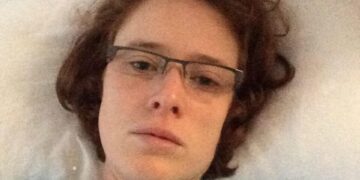 Cape Town woman hoping to fly to UK for life-changing spinal surgery