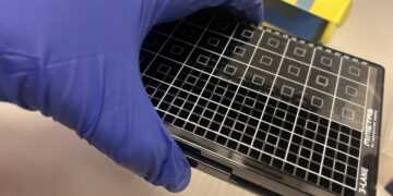 An example of the iPlacenta - a gloved hand holding a black tray