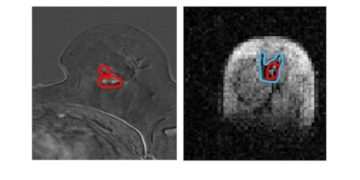 An image of brain scans,