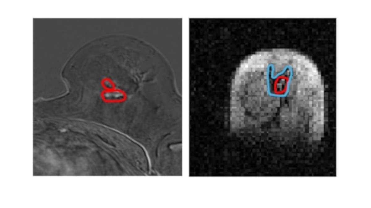 An image of brain scans,